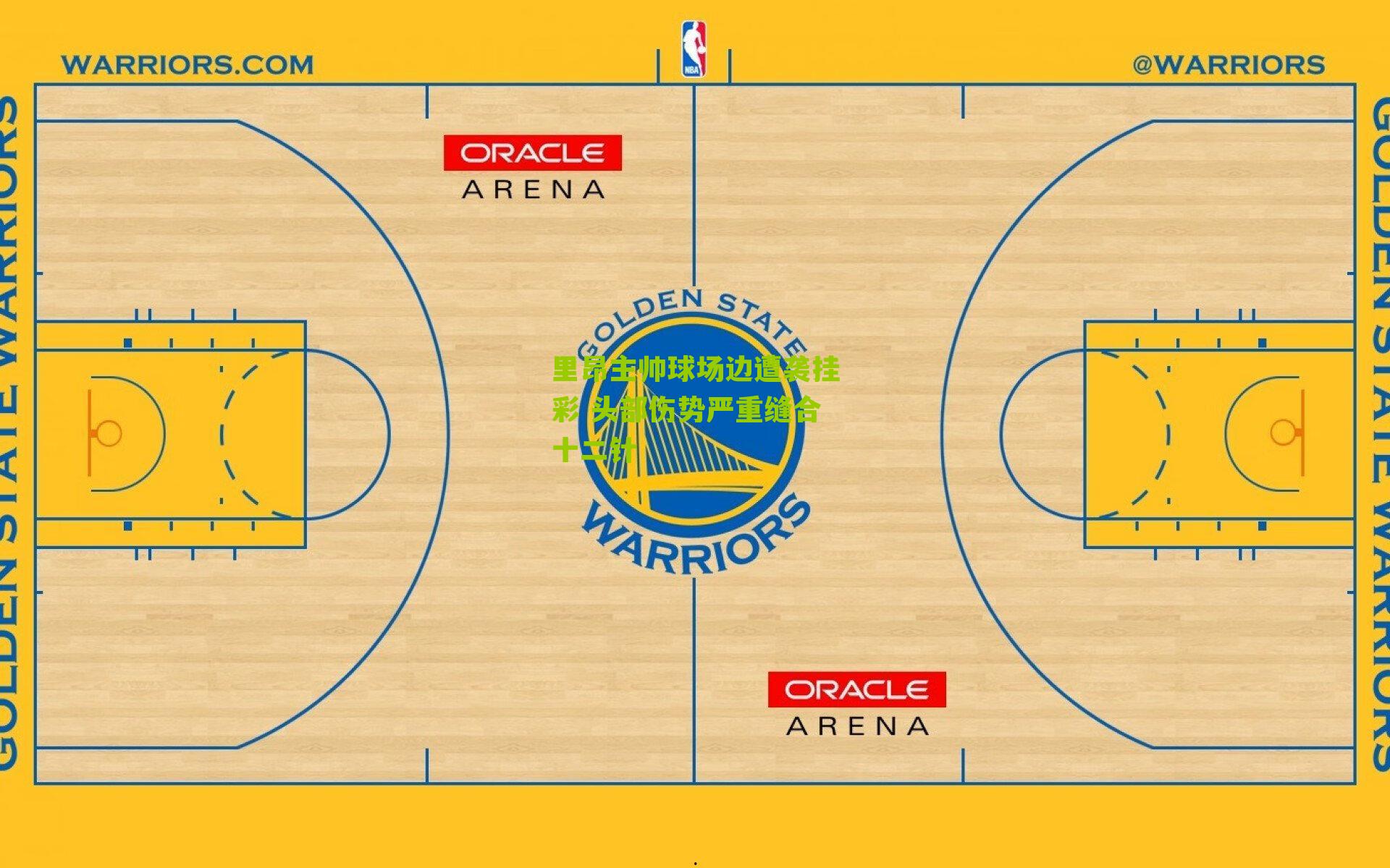 里昂主帅球场边遭袭挂彩 头部伤势严重缝合十二针